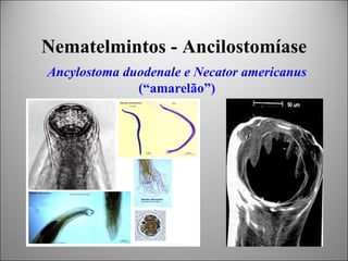 Nematelmintos - Ancilostomíase
Ancylostoma duodenale e Necator americanus
              (“amarelão”)
 