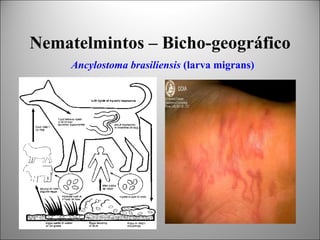 Nematelmintos – Bicho-geográfico
     Ancylostoma brasiliensis (larva migrans)
 