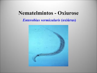 Nematelmintos - Oxiurose
 Enterobius vermicularis (oxiúrus)
 