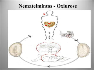 Nematelmintos - Oxiurose
Asquelmintos (nematelmintos)
   Enterobius vermicularis (oxiúrus)
 