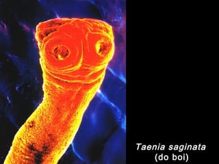 Taenia saginata
(do boi)