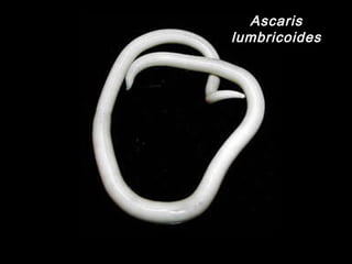 Ascaris
lumbricoides
