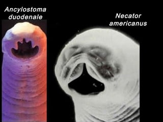 Ancylostoma
duodenale Necator
americanus