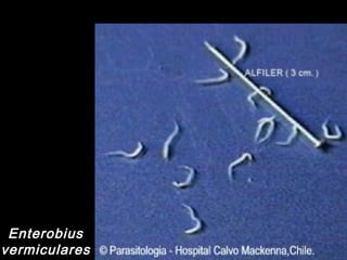 Enterobius
vermiculares