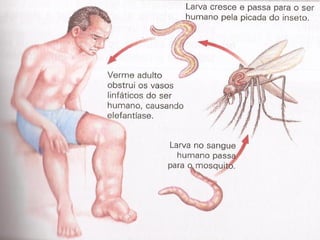 Verminoses