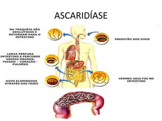 ASCARIDÍASE
 