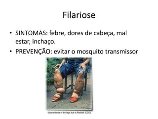 Filariose
• SINTOMAS: febre, dores de cabeça, mal
estar, inchaço.
• PREVENÇÃO: evitar o mosquito transmissor
 