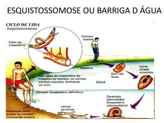 ESQUISTOSSOMOSE OU BARRIGA D ÁGUA
 