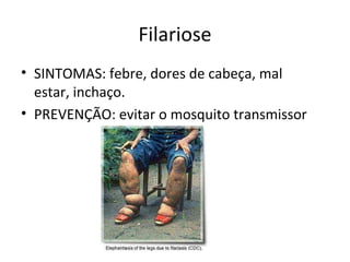 Filariose
• SINTOMAS: febre, dores de cabeça, mal
estar, inchaço.
• PREVENÇÃO: evitar o mosquito transmissor
 