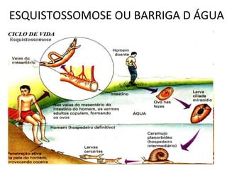 ESQUISTOSSOMOSE OU BARRIGA D ÁGUA
 