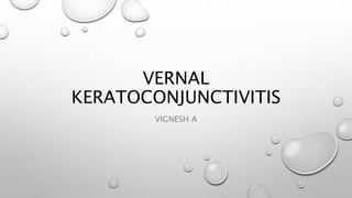 VERNAL 
KERATOCONJUNCTIVITIS 
VIGNESH A 
 