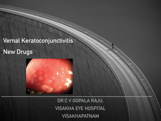 TITLE TEXT
DR C V GOPALA RAJU,
VISAKHA EYE HOSPITAL
VISAKHAPATNAM
Vernal Keratoconjunctivitis
New Drugs
stage. Limbal papillae tend to be
gelatinous and conﬂuent (Fig. 3).
Bonini et al. (2000) graded the papil-
lae on the upper tarsal conjunctiva or
at the corneoscleral limbus as follows:
(1) Grade 0: no papillary reaction.
(2) Grade 1+: few papillae, 0.2 mm
widespread over the tarsal conjunctiva
or around the limbus.
(3) Grade 2+: papillae of 0.3–1 mm
over the tarsal conjunctiva or at the
limbus.
(4) Grade 3+: papillae of 1–3 mm all
over the tarsal conjunctiva or for 360°
around the limbus.
(5) Grade 4+: papillae of more than
3 mm over the tarsal conjunctiva or
gelatinous appearance at the limbus
covering the peripheral cornea.
Based on the predominant involvement
of either tarsal or limbal conjunctiva,
VKC can be divided into palpebral,
bulbar or mixed type with limbal forms
being prevalent in non-White patients
(Verin et al. 1999).
Photophobia, pain and foreign
body sensation are caused by involve-
ment of the cornea. Corneal changes
include punctate epithelial keratitis,
epithelial macro-erosions, shield ulcer,
plaque formation and late corneal
vascularization (Allansmith & Ross
1988; Buckley 1988). Coalescence of
punctate epithelial keratitis areas leads
to frank corneal epithelial erosion,
leaving Bowman’s membrane intact.
If untreated, a plaque containing
ﬁbrin and mucus deposits over the
epithelial defect (Rahi et al. 1985).
Epithelial healing is then impaired,
and new vessel growth is encouraged.
The oval-shaped epithelial defects,
known as shield ulcers (Fig. 4), usu-
ally have their lower border in the
upper half of the visual axis. Healed
shield ulcers may leave a subepithelial
ring-like scar (Fig. 5). Corneal ulcer is
reported to occur in 3–11% of
patients. Corneal changes cause per-
manent reduction in visual acuity in
6% of patients suffering from VKC
(Neumann et al. 1959; Cameron 1995a;
Tabbara 1999). Pseudogerontoxon,
which resembles arcus senilis, is a wax-
ing and waning grey-white lipid deposi-
tion in the superﬁcial stroma of the
peripheral cornea.
Signs of VKC are conﬁned mostly
to the conjunctiva and cornea. The
skin of the lid and lid margin are rela-
tively uninvolved. The conjunctiva of
the fornices does not usually show
foreshortening and symblepharon
formation. Iritis is not reported to
occur in VKC. Ocular complications
of VKC have been reported to
include steroid-induced cataract and
glaucoma, corneal scarring, microbial
keratitis and limbal tissue hyperplasia
(Sridhar et al. 2003). Amblyopia seen
among VKC may be caused by cor-
neal opacity, irregular astigmatism
and keratoconus. Dry eye syndrome,
reported in patients suffering from
VKC, may be caused by unsupervised
use of topical corticosteroids (Tabbara
1999).
No precise diagnostic criteria have
been established for this disease.
Hyperaemia, itching, photophobia,
tearing and mucus discharge are
Fig. 1. Horner-Tranta’s dots.
Fig. 2. Cobble stone papillae.
Acta Ophthalmologica 2009
 