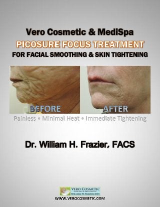 Vero Cosmetic & MediSpa
FOR FACIAL SMOOTHING & SKIN TIGHTENING
Painless • Minimal Heat • Immediate Tightening
Dr. William H. Frazier, FACS
 