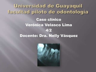 Caso clínico
Verónica Velasco Lima
4/2
Docente: Dra. Nelly Vásquez
 
