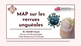 MAP sur les
verrues
unguéales
Dr. OUADI Imane
Service de dermatologie
CHU Mohammed VI-Oujda
 