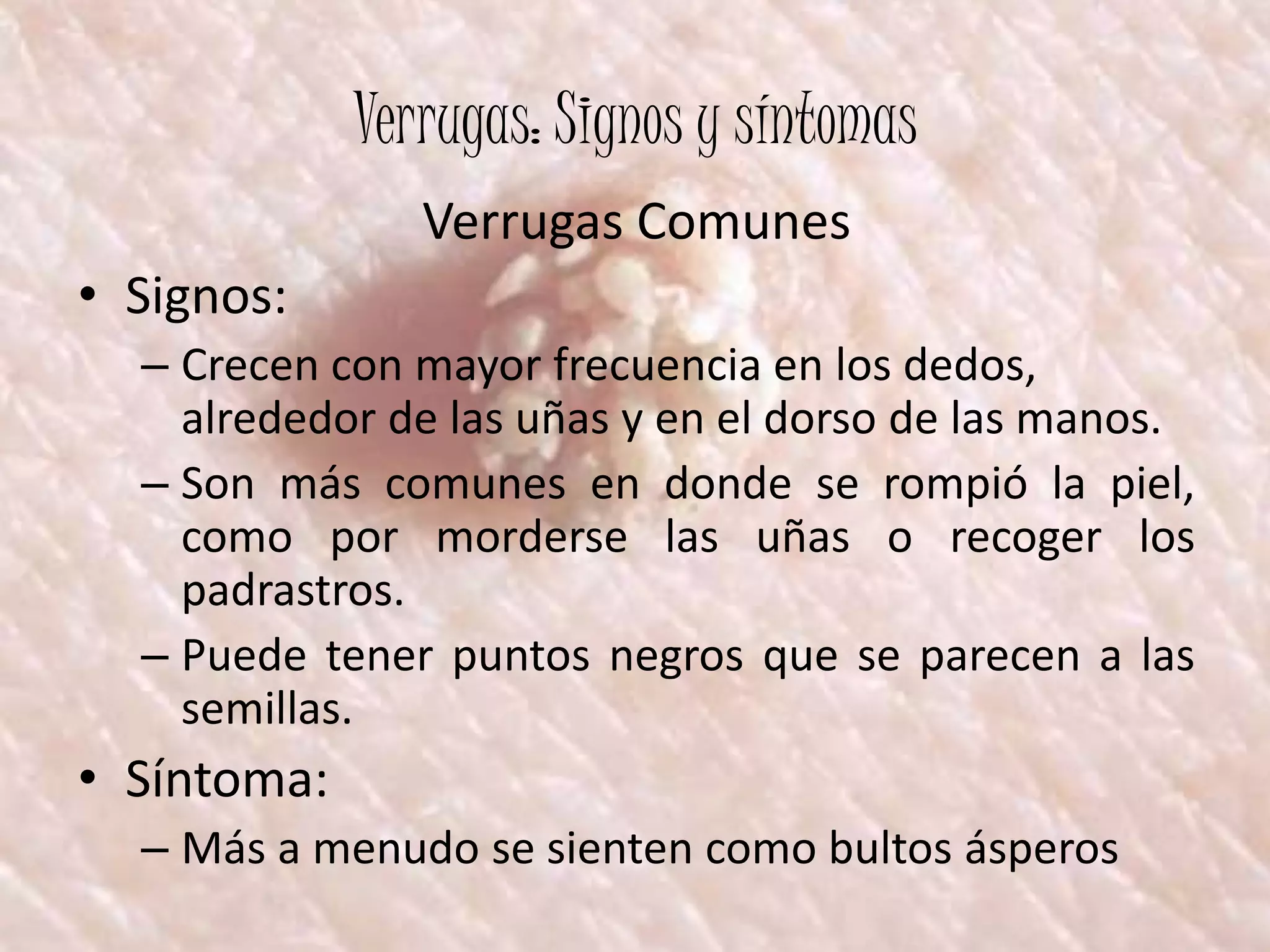 Verrugas, herpes, mixovirus | PPSX