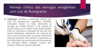 Manejo clínico das verrugas anogenitais
com uso de fluxograma
 Crioterapia: promove a destruição térmica por
meio de equipamentos específicos resfriados
(nitrogênio líquido ou CO2), eliminando as
verrugas por citólise térmica. É útil quando há
poucas lesões ou em lesões muito queratinizadas.
Pode ser necessária a realização de mais de uma
sessão terapêutica, respeitando um intervalo de
uma a duas semanas entre as sessões. Raramente
necessita anestesia. Pode facilitar o tratamento se
há muitas lesões ou envolvimento de área extensa.
Os principais efeitos colaterais incluem dor,
eritema e bolhas no local da aplicação.
 
