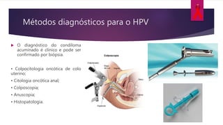 Métodos diagnósticos para o HPV
 O diagnóstico do condiloma
acuminado é clínico e pode ser
confirmado por biópsia.
• Colpocitologia oncótica de colo
uterino;
• Citologia oncótica anal;
• Colposcopia;
• Anuscopia;
• Histopatologia.
 