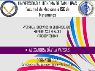 DERMATOLOGIA
•VERRUGA (QUERATOSIS) SEBORREICAEICA
•HIPERPLASIA SEBACEA
•TRICOEPITELIOMA
• ALEXANDRA DÀVILA VARGAS
UNIVERSIDAD AUTONOMA DE TAMULIPAS
Facultad de Medicina e ISC de
Matamoros
Catedratico: Dr. Salvador Sobrevilla Ondarza
 