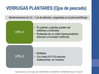VERRUGAS PLANTARES (Ojos de pescado)
Neoformaciones de 0.5 - 1 cm de diámetro, engastadas en la piel (endofíticas)
• En palmas y plantas pueden ser
solitarias y profundas
• Rodeadas de un collar hiperqueratósico
doloroso a la presión (helioma)
VPH-1
• Múltiples
• Con hasta 40 0 50 lesiones
coalescentes, en mosaico
VPH-2
Roberto Arenas Guzman. (2013). Verrugas virales. En DERMATOLOGÍA, ATLAS, DIAGNÓSTICO Y TRATAMIENTO(937). Mexico D.F.: McGraw Hill.
 