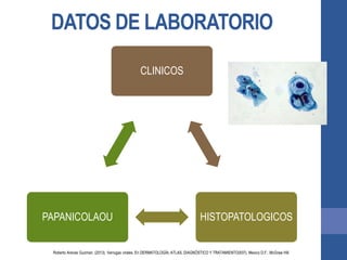 DATOS DE LABORATORIO
CLINICOS
HISTOPATOLOGICOSPAPANICOLAOU
Roberto Arenas Guzman. (2013). Verrugas virales. En DERMATOLOGÍA, ATLAS, DIAGNÓSTICO Y TRATAMIENTO(937). Mexico D.F.: McGraw Hill.
 