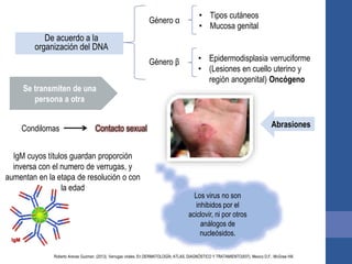 De acuerdo a la
organización del DNA
Género α
• Tipos cutáneos
• Mucosa genital
Género β • Epidermodisplasia verruciforme
• (Lesiones en cuello uterino y
región anogenital) Oncógeno
Se transmiten de una
persona a otra
Condilomas Contacto sexual Abrasiones
IgM cuyos títulos guardan proporción
inversa con el numero de verrugas, y
aumentan en la etapa de resolución o con
la edad
Los virus no son
inhibidos por el
aciclovir, ni por otros
análogos de
nucleósidos.
Roberto Arenas Guzman. (2013). Verrugas virales. En DERMATOLOGÍA, ATLAS, DIAGNÓSTICO Y TRATAMIENTO(937). Mexico D.F.: McGraw Hill.
 