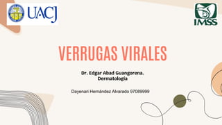 VERRUGAS VIRALES
Dr. Edgar Abad Guangorena.
Dermatología
Dayenari Hernández Alvarado 97089999
 