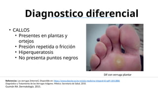 Verrugas virales - Islas Cortes Ernesto 7HM8-DESKTOP-ISLAS 1.pptx