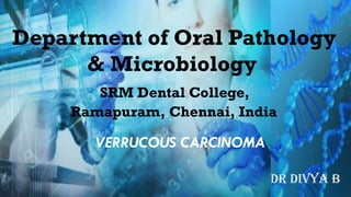 VERRUCOUS CARCINOMA
DR DIVYA B
Department of Oral Pathology
& Microbiology
SRM Dental College,
Ramapuram, Chennai, India
 