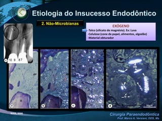 Etiologia do Insucesso EndodônticoBASES BIOLÓGICAS