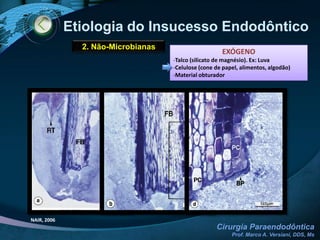 Etiologia do Insucesso EndodônticoBASES BIOLÓGICAS