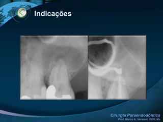 Celulose (cone de papel, alimentos, algodão)