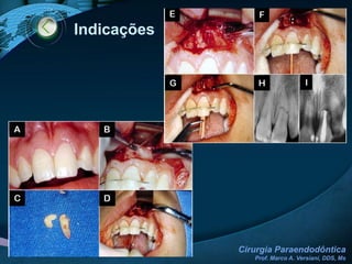 Sucesso: Cirurgia
