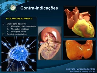 Sucesso: Cirurgia