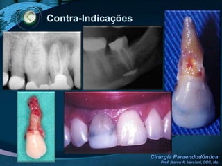 Falhas do TE Convencional1 ANO2 ANOS