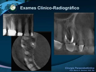 Contra-IndicaçõesRELACIONADAS AO PACIENTE Estado geral de saúdeAlterações cárdio-vascularesAlterações hepáticasAlterações renais Condições psicológicas