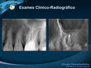 Contra-IndicaçõesRELACIONADAS AO OPERADOR ConhecimentoHabilidadeMaterial / Instrumental