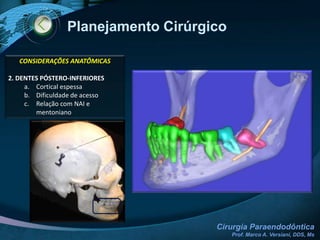 Exames Clínico-RadiográficoExame  ClínicoAnamneseInspeção Palpação/PalpaçãoMobilidadeTeste de sensibilidadeExames laboratoriaisTempo de coagulaçãoTempo de sangramentoExames imaginológicosPeriapicalOclusalPanorâmicaTC Cone BeamTamanho e localização da lesãoRelação com estruturas vizinhasDente(s) envolvido(s)