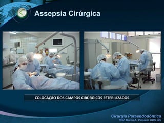 Planejamento CirúrgicoCONSIDERAÇÕES ANATÔMICAS1. DENTES ÂNTERO-SUPERIORESCortical mais finaMaior facilidade de acessoPode haver íntima relação com a fossa nasal
