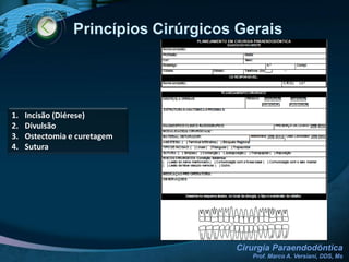 Cuidados Pré-OperatóriosAvaliar o paciente em seu aspecto físico e psicológicoAvaliar os riscos cirúrgicosSe necessário, verificar tempo de sangramento e coagulaçãoVerificar necessidade de medicamento tranquilizanteValium (diazepan) 5 mg 1 comp. à noite do dia anterior e um antes da cirurgia (potencializa o efeito do anestésico local)Realizar profilaxia dental e raspagem com remoção de lesões cariosas e selamento de cavidadesReduzir a contaminação oral com prescrição de soluções para bochecho (solução aquosa de digluconato de clorexidina 0,12%)Prescrever anti-inflamatório + antibiótico com início 1 dia antes do procedimento (Diclofenaco 50 mg + Amoxilina 500 mg / Celecoxib 100 mg + Clindamicina 300 mg) (3 dias + 5 dias)