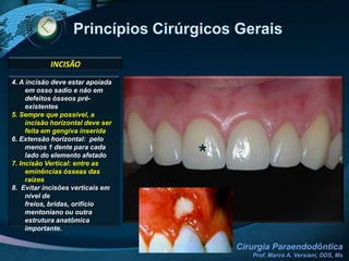 AnestesiaPRÉ-MOLARES SUPERIORESTERMINAL INFILTRATIVA (palato)BLOQUEIO REGIONALa) Forame Infra-Orbitário (NAS anterior e médio)