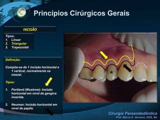 Assepsia CirúrgicaProfilaxia  (consulta anterior)Assepsia Intra-Oral: Solução aquosa de digluconato de clorexidina  0,12%Assepsia Extra-Oral: Solução aquosa de digluconato de clorexidina 0,2%Paramentação