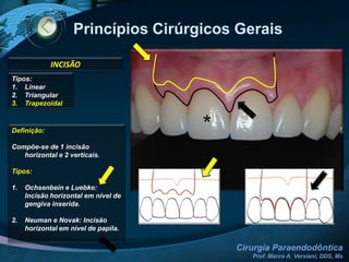 ParamentaçãoCOLOCAÇÃO DAS LUVAS CIRÚRGICAS ESTÉREIS