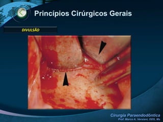Montagem da Mesa ClínicaSuturaRecipientes metálicos, sugadores, afastadores, brocas, seringas, gaze, outros instrumentos auxiliaresDivulsãoCuretagemAnestesiaIncisão