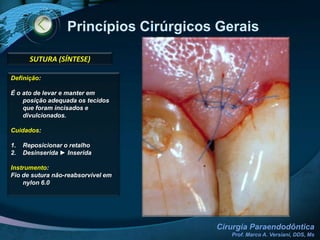 Princípios Cirúrgicos Gerais INCISÃO4. A incisão deve estar apoiada em osso sadio e não em defeitos ósseos pré-existentes5. Sempre que possível, a incisão horizontal deve ser feita em gengiva inserida6. Extensão horizontal:  pelo menos 1 dente para cada lado do elemento afetado7.Incisão Vertical: entre as eminências ósseas das raízes8.  Evitar incisões verticais em nível de freios, bridas, orifício mentoniano ou outra estrutura anatômica importante.*