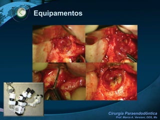 Princípios Cirúrgicos Gerais SUTURA (SÍNTESE)Definição:É o ato de levar e manter em posição adequada os tecidos que foram incisados e divulcionados.Cuidados:Reposicionar o retalhoDesinserida ► InseridaInstrumento:Fio de sutura não-reabsorvível em nylon 6.0