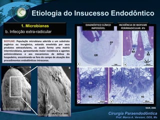 RESTAURAÇÃO DENTAL (± 25 A 45 DIAS)