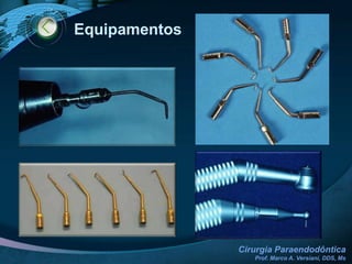 Princípios Cirúrgicos Gerais SUTURA (SÍNTESE)Tipos:SIMPLES – pode ser usada em qualquer tipo de incisão7 dias