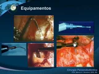 Princípios Cirúrgicos Gerais SUTURA (SÍNTESE)Tipos:CONTENÇÃO (suspensório) – Quando a simples não permitir boa coaptação da incisão horizontal.