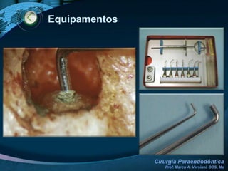 Cuidados Pós-Cirúrgicos